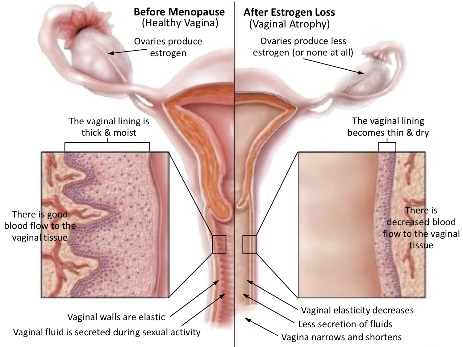 Diagram of before and after menopause